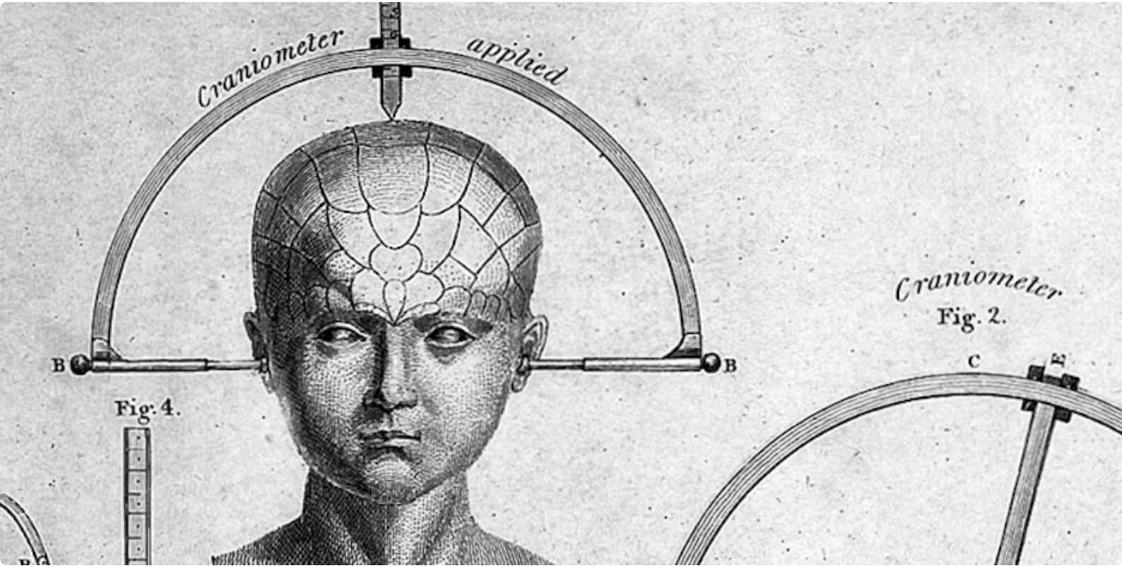Fragment of what looks like a 19th-century black and white medical illustration. It shows an androgynous human face from the neck up. The skill seems slightly oversized in the top half, as if holding a very large brain. An instrument encircles the top of the head and appears to be measuring the distance from ear to ear, with the label 'Craniometer applied'